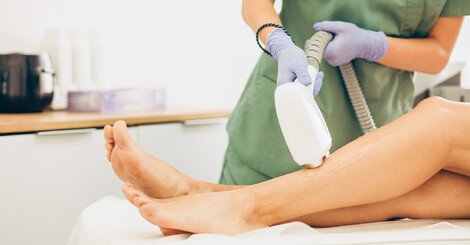 Trvalá epilace: velké srovnání IPL a laserové epilace