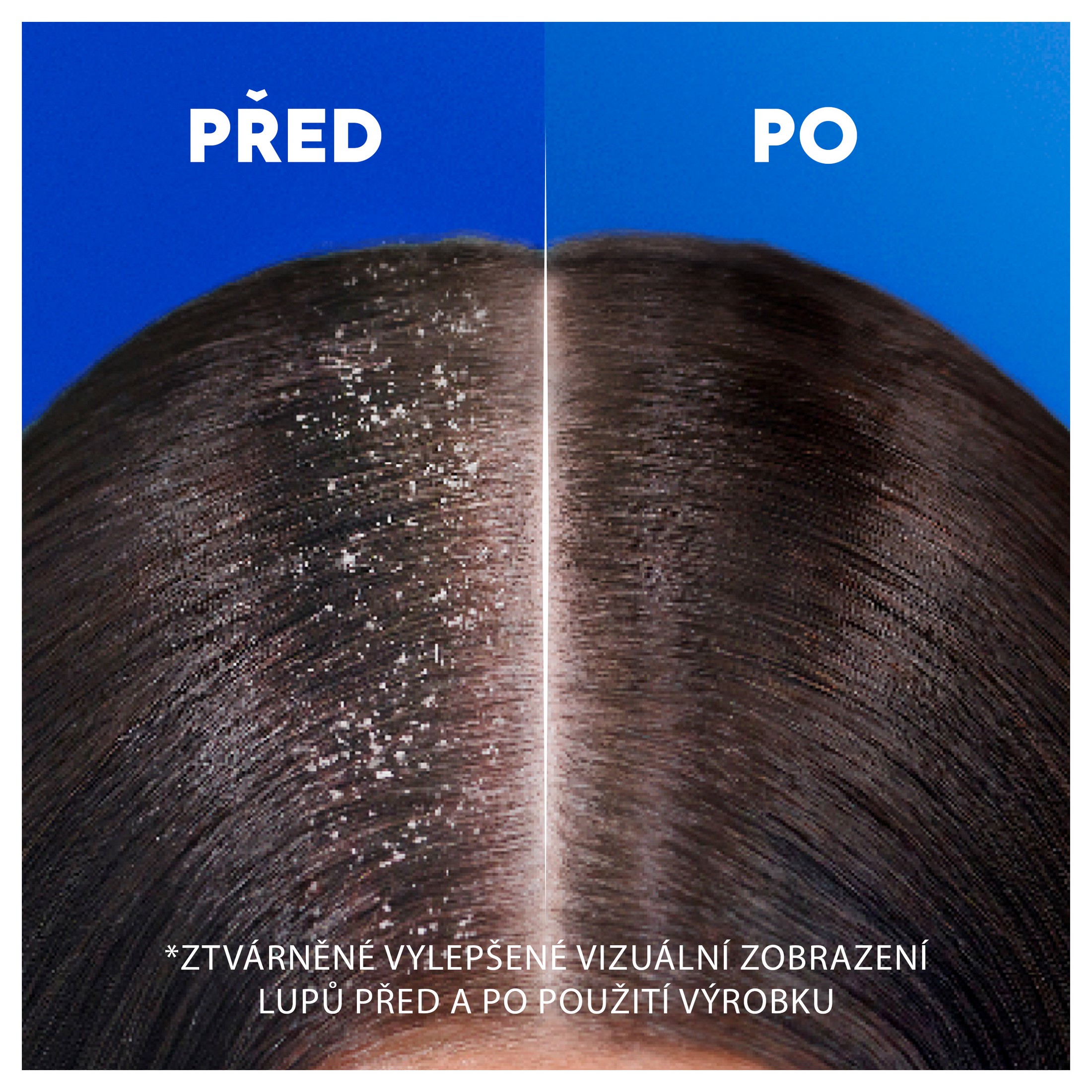 Head & Shoulders Smooth & Silky šampon proti lupům 250 ml